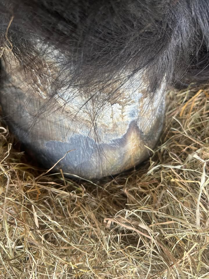 After Abscess Hole